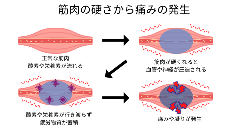 筋肉の硬さから痛みや凝りが発生